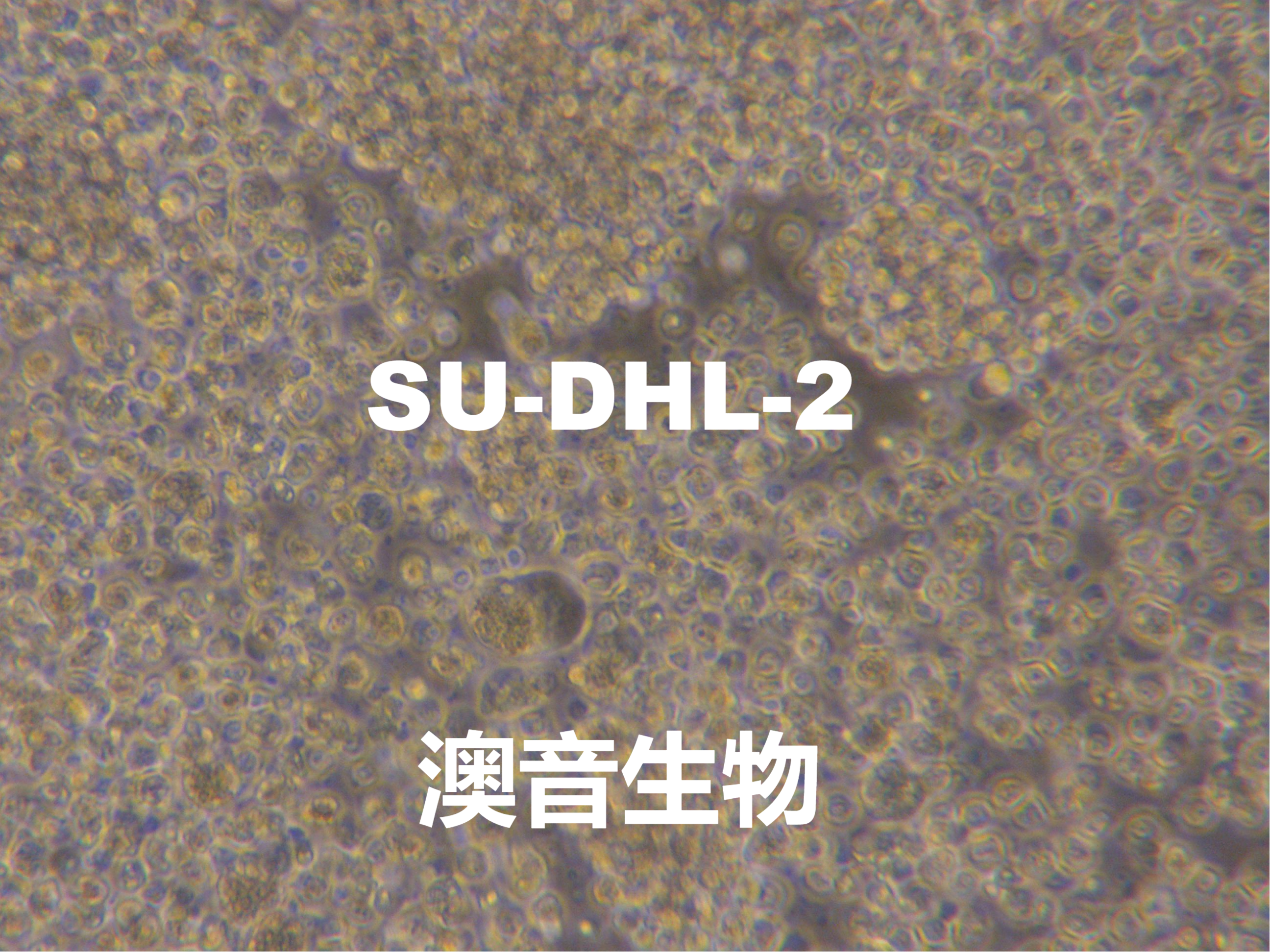 SU-DHL-2【SUDHL2; SUDHL-2; Su-D