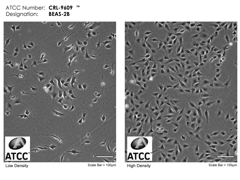 BEAS-2B【Beas-2B; BEAS 2B; BEAS