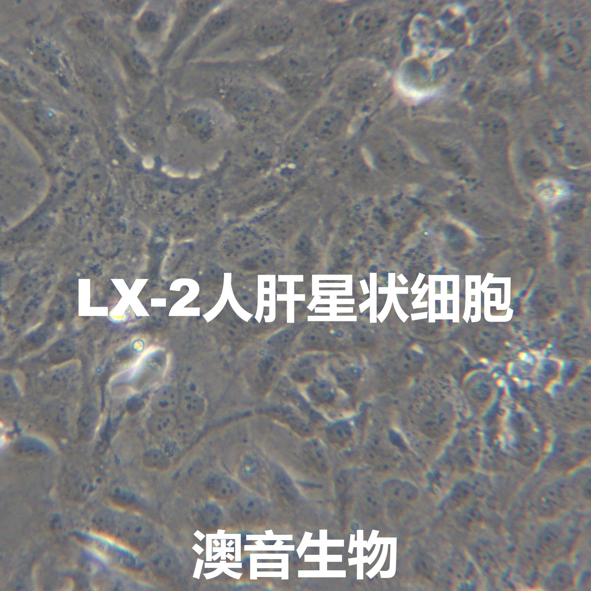 LX-2【LX2;lx2】肝星形细胞