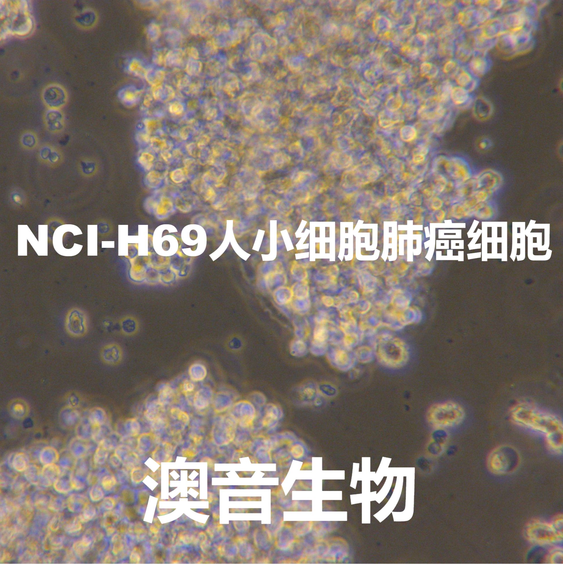 NCI-H69[CI-H-69; NCI H69; H69; H-69; NCIH69; NCI-HUT-69; H69/P; NCI-H69C; H69C; H69c]小细胞肺癌细胞