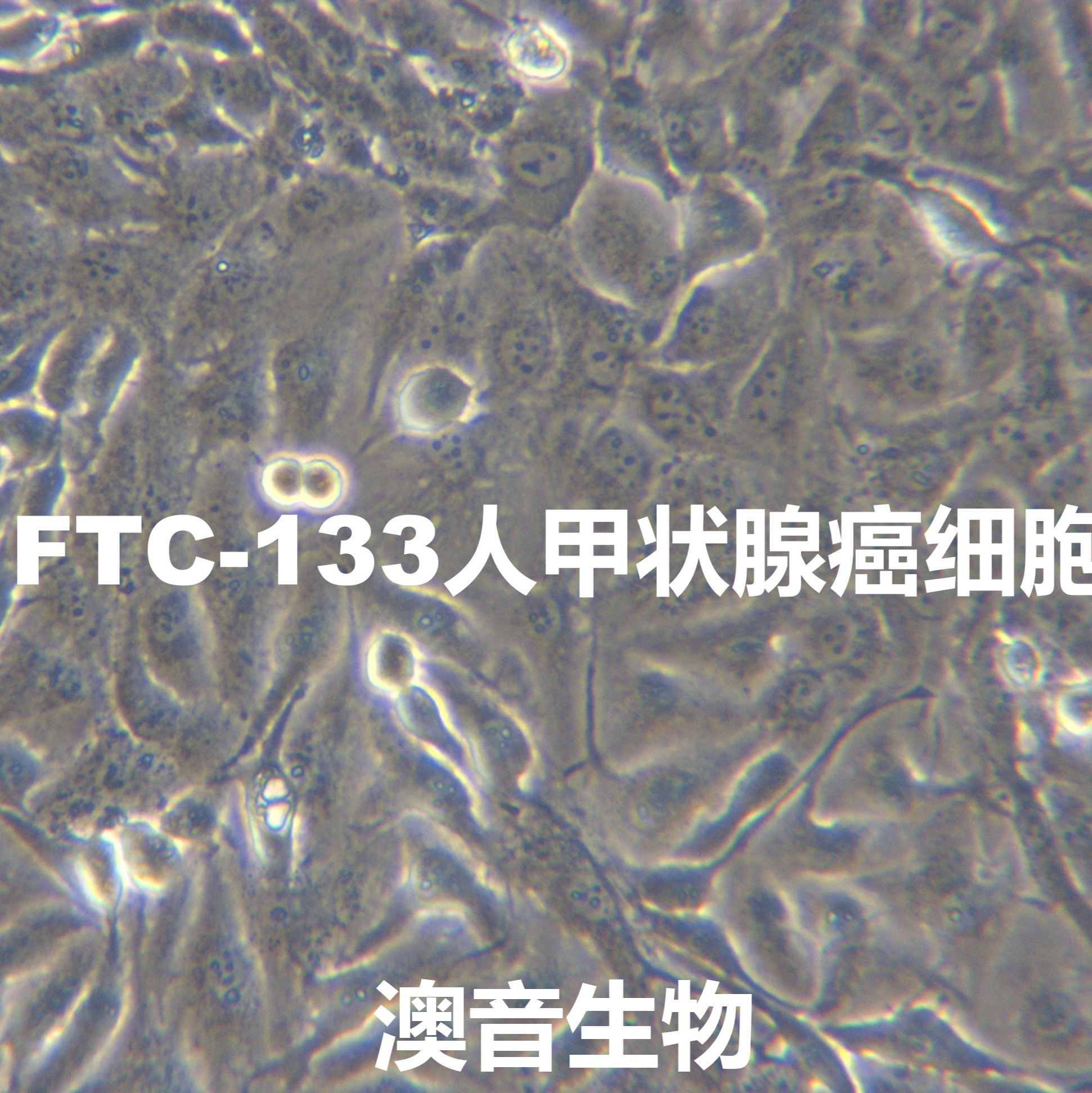 FTC-133[	FTC133]甲状腺癌细胞