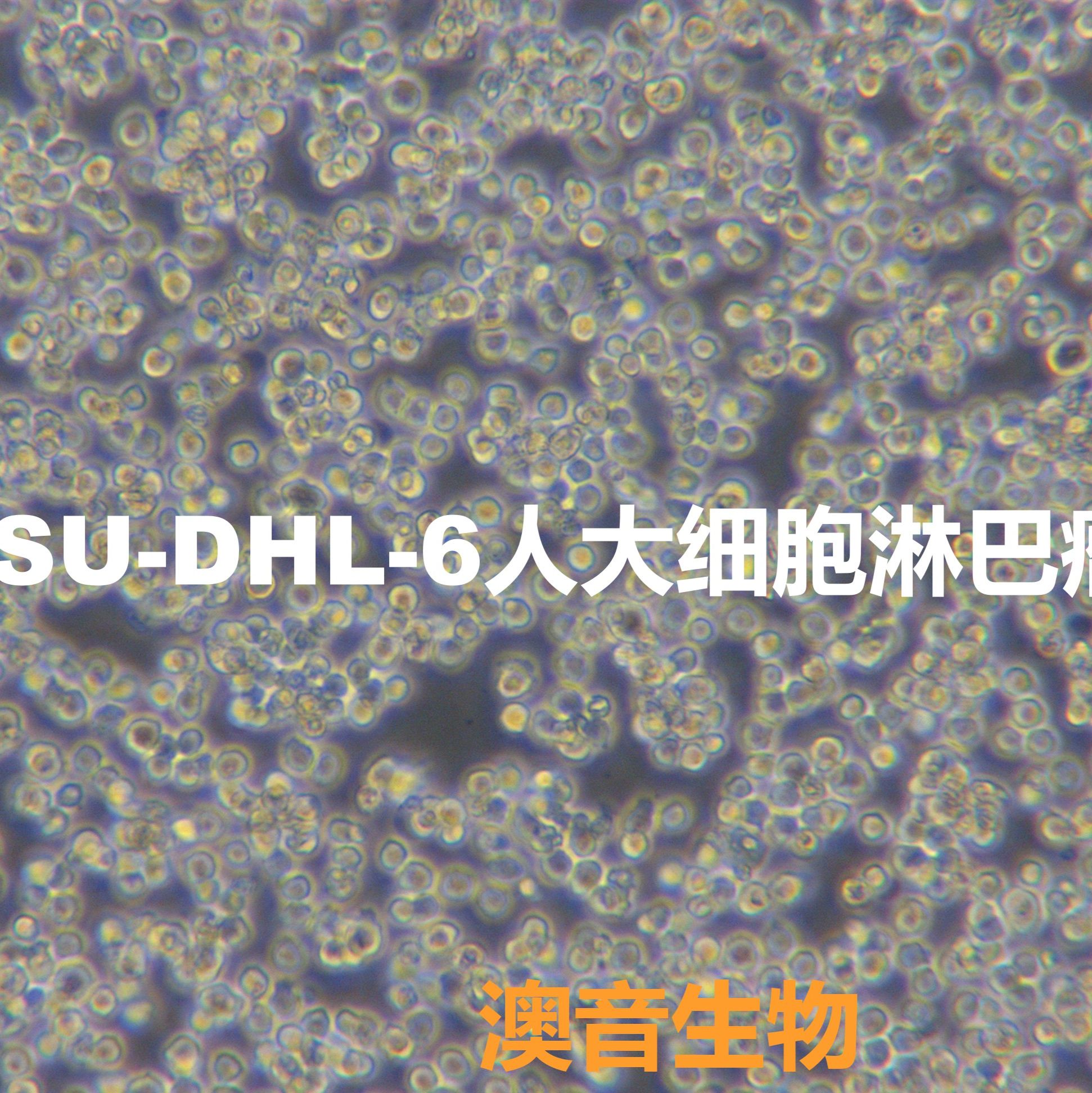 SU-DHL-6[SUDHL6; SuDHL6; SU-DHL6; SUDHL-6; SuDHL-6; Sudhl-6; SUD6]大细胞淋巴瘤细胞