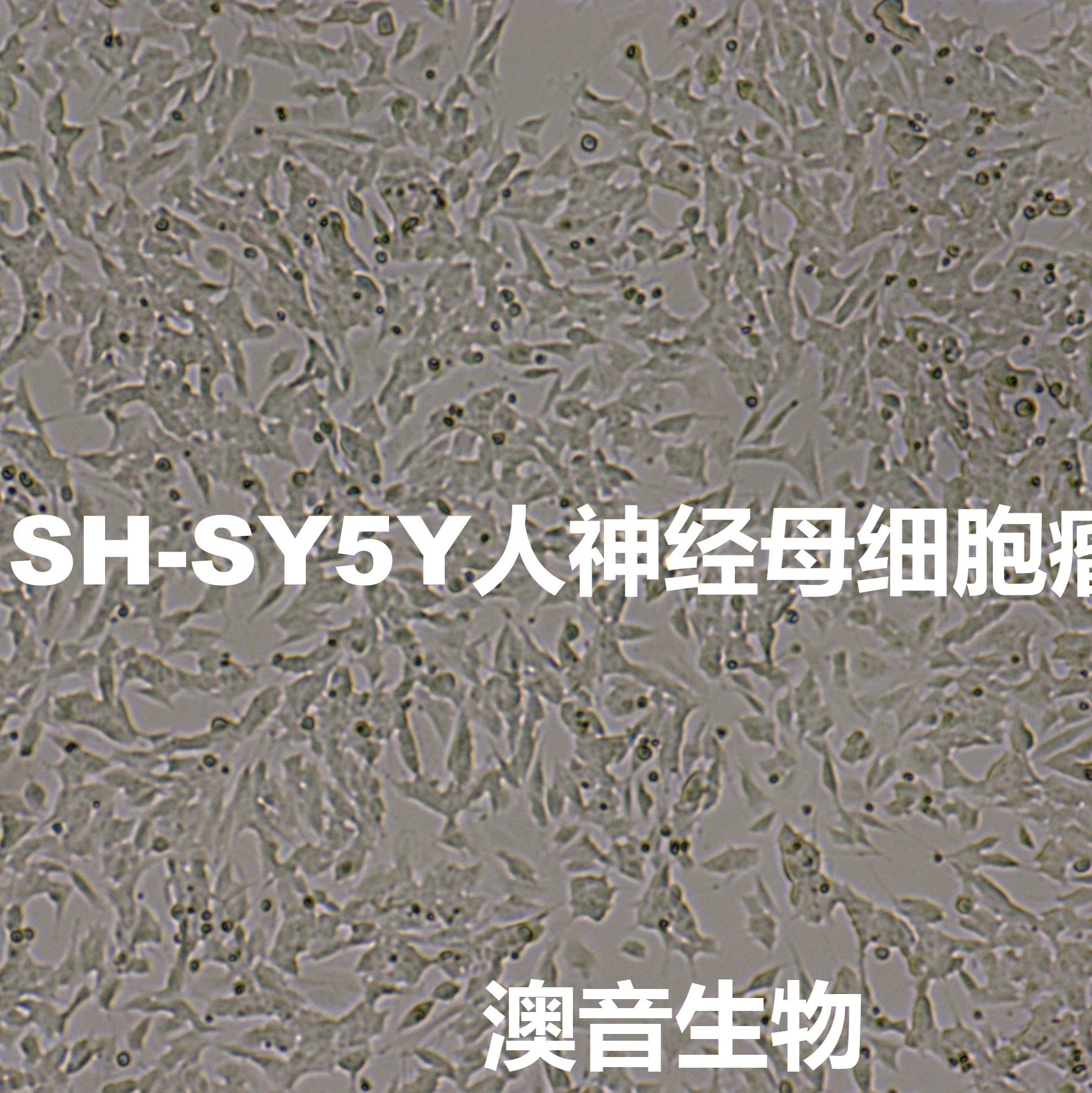 SH-SY5Y【SH-Sy5y; SHSY5Y; SHSY-5Y; SK-SH-SY5Y; SY5Y】神经母细胞瘤细胞