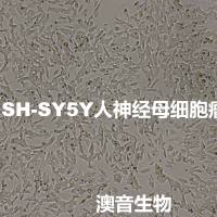 SH-SY5Y【SH-Sy5y; SHSY5Y; SHSY-5Y; SK-SH-SY5Y; SY5Y】神经母细胞瘤细胞