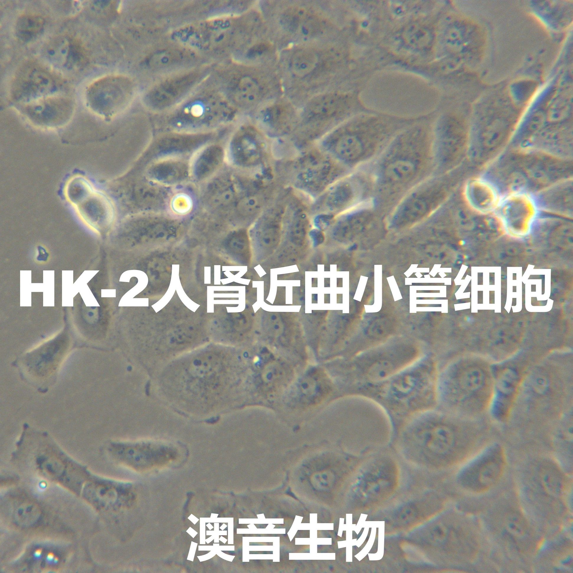HK-2[Hk-2; HK2; Human Kidney-2]肾近曲小管细胞