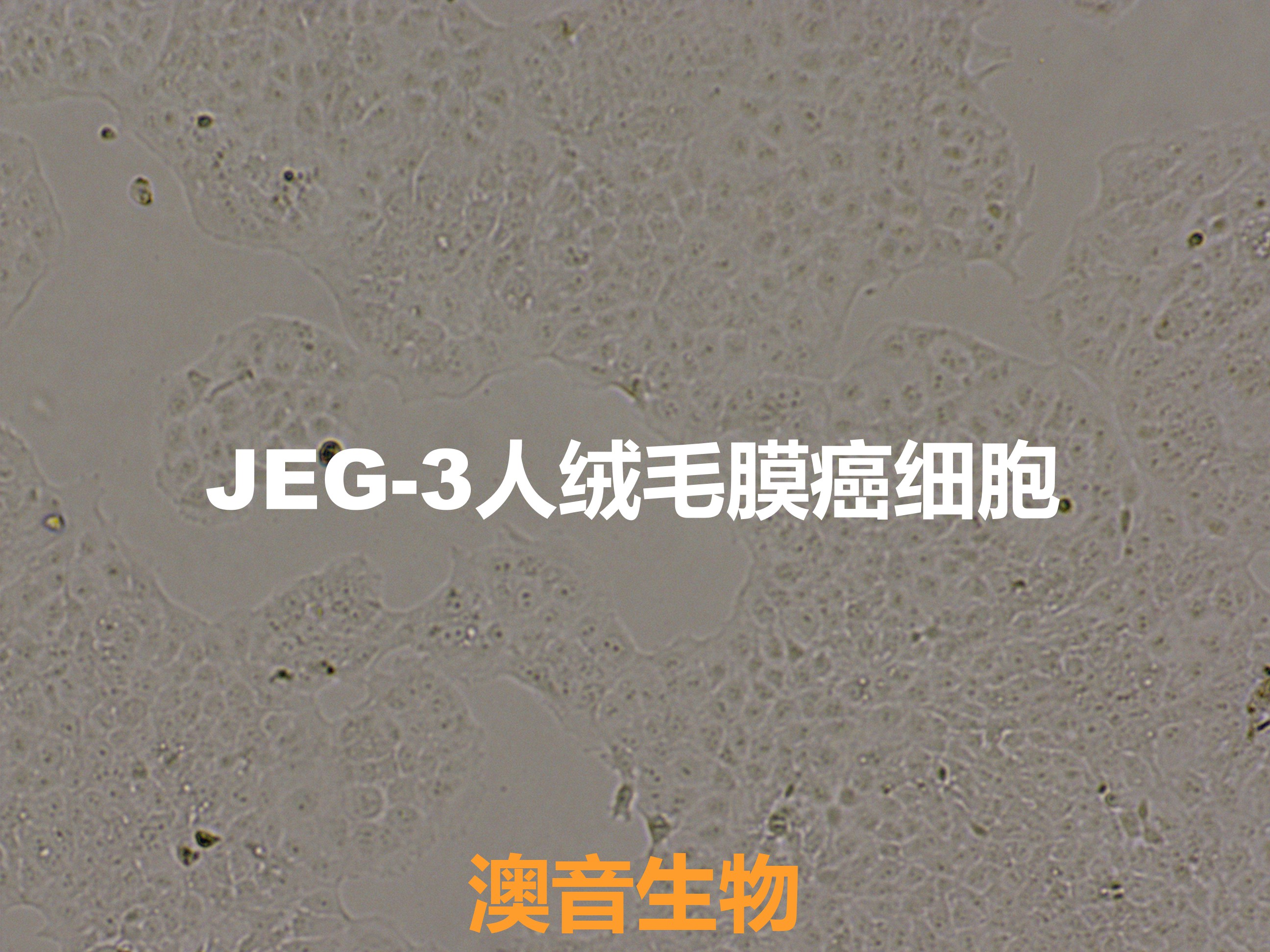 JEG-3[Jeg-3; JEG3; Jeg3; jeg3]