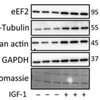Western blot检测|蛋白质印迹(western blot)技术服务