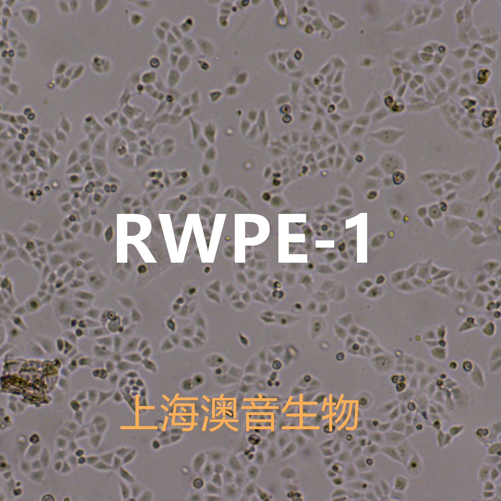 RWPE-1【RWPE1】正常前列腺上皮细胞