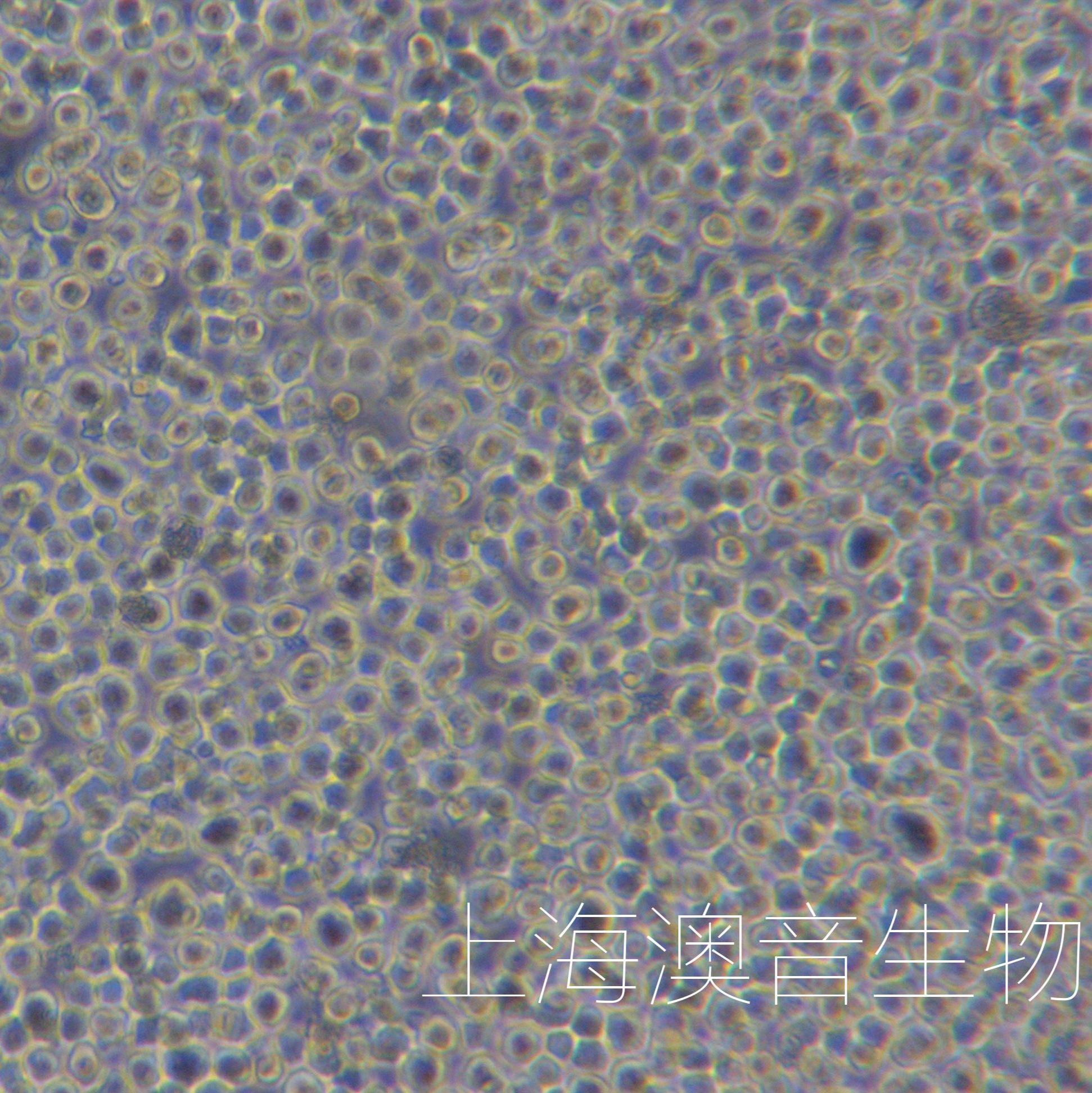 U266B1多发性骨髓瘤细胞