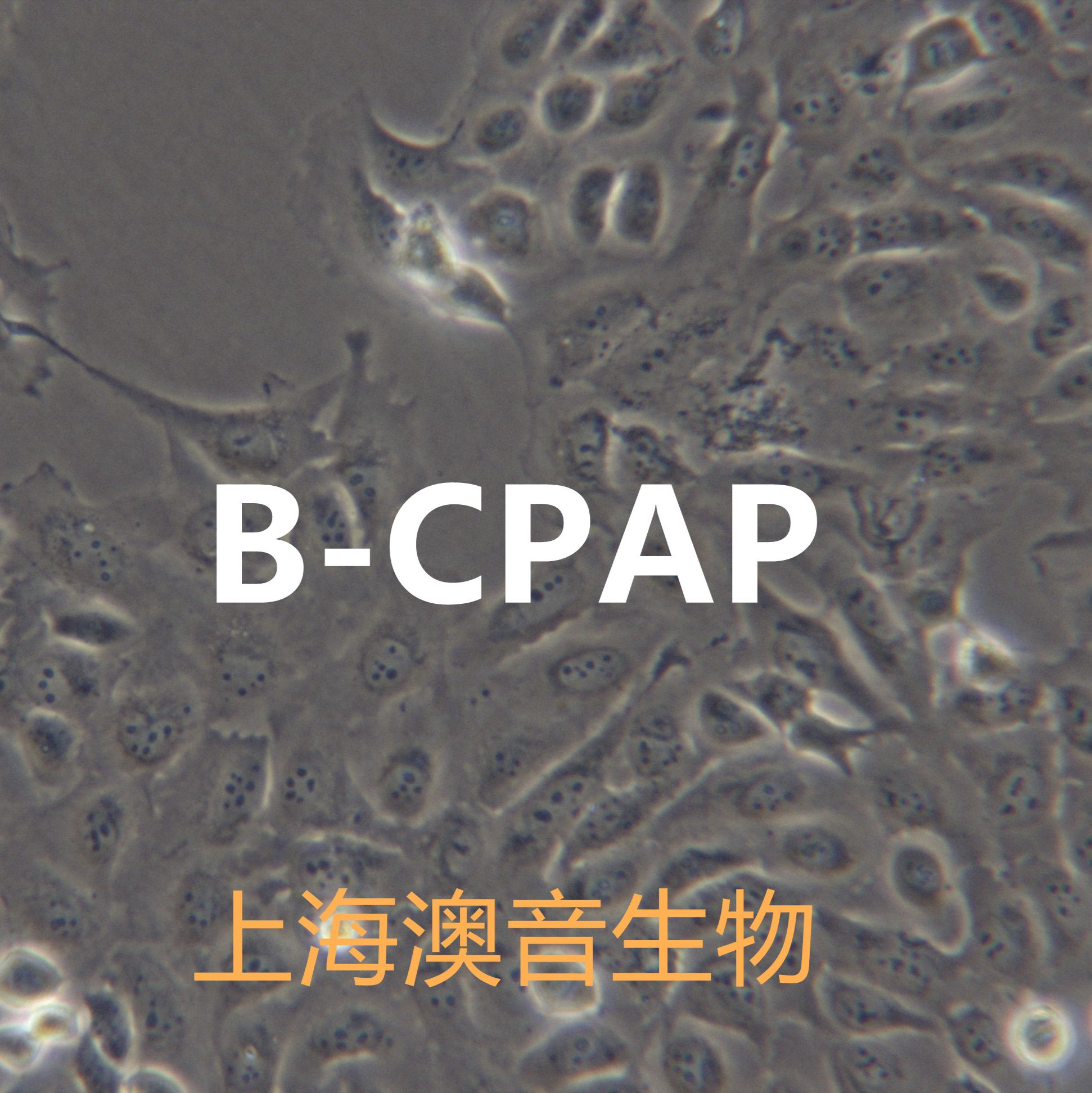 B-CPAP【BC-PAP; BCPAP】甲状腺癌细胞