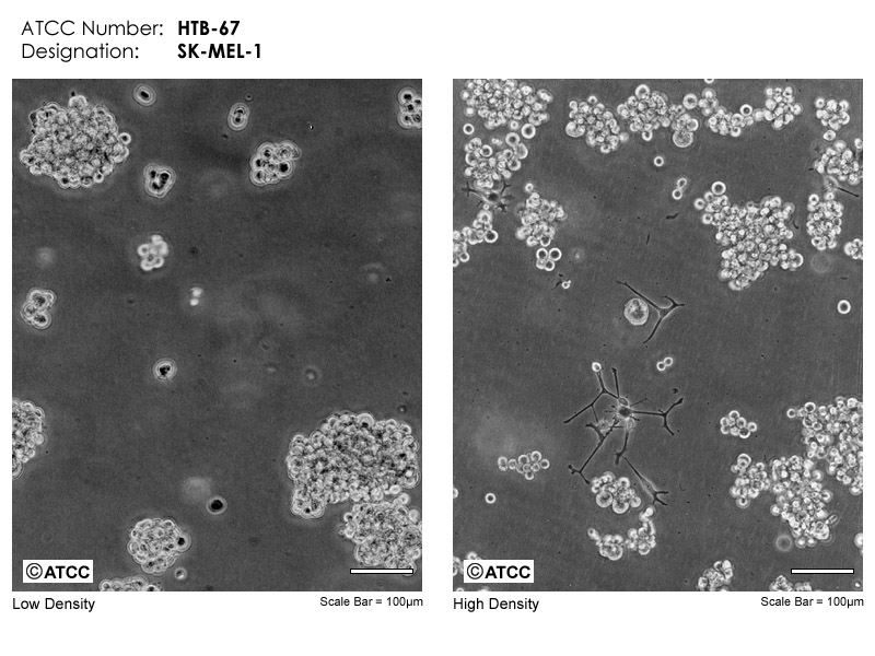 SK-MEL-1[SK-Mel-1; SK Mel 1; S