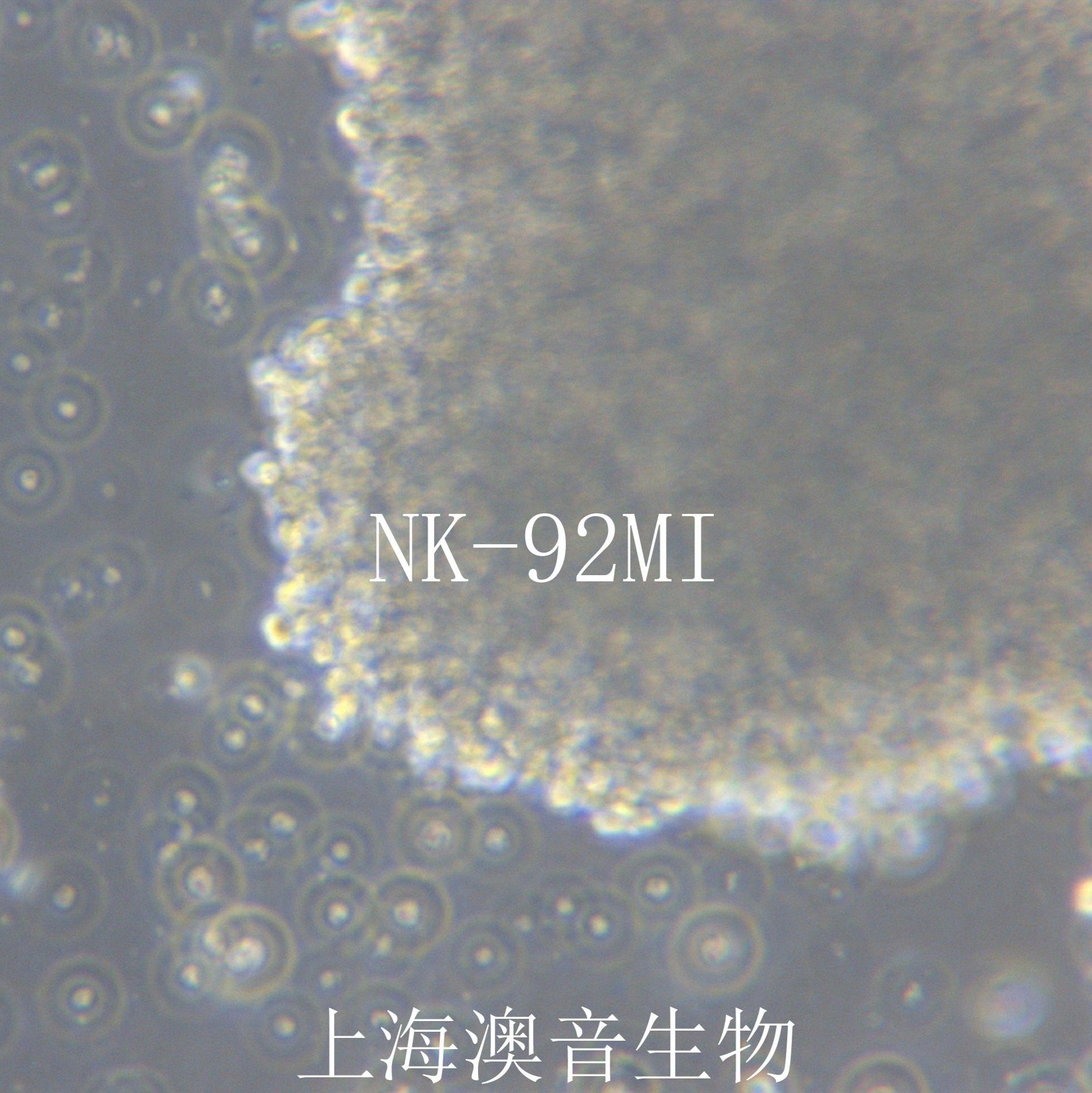 NK-92MI [NK92MI]恶性非霍奇金淋巴瘤患者的自然杀伤细胞