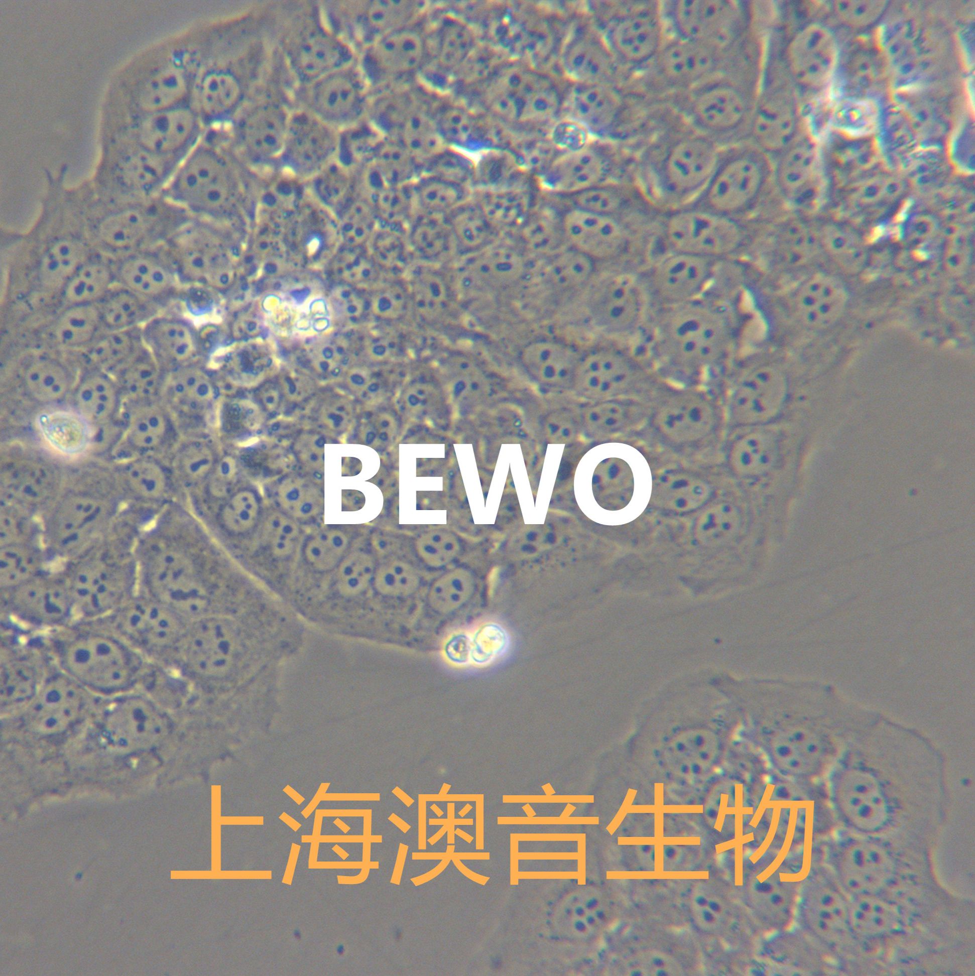 BeWo[BEWO; Be Wo; Be-Wo]胎盘绒膜癌细胞