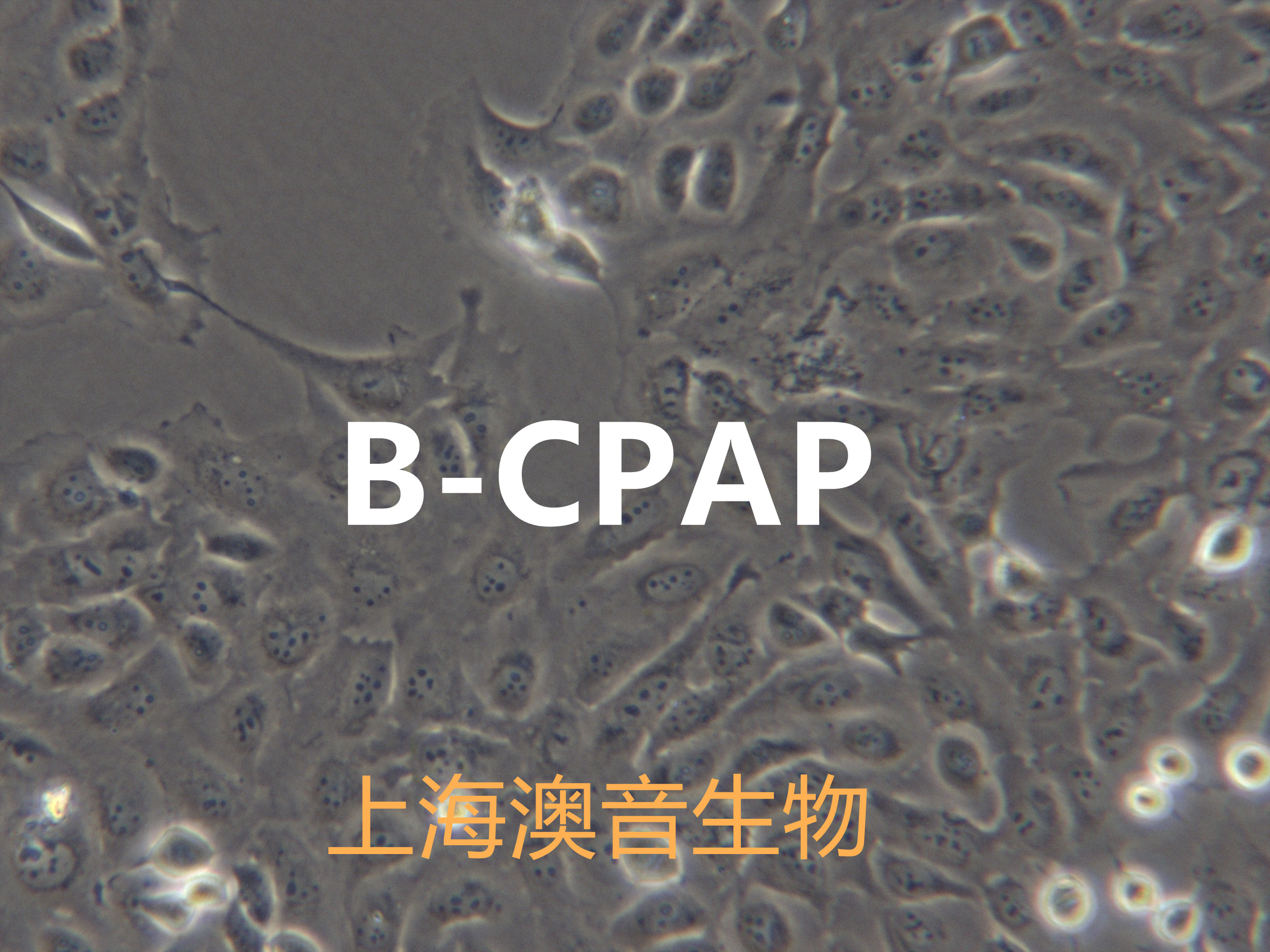 B-CPAP【BC-PAP; BCPAP】甲状腺癌细胞