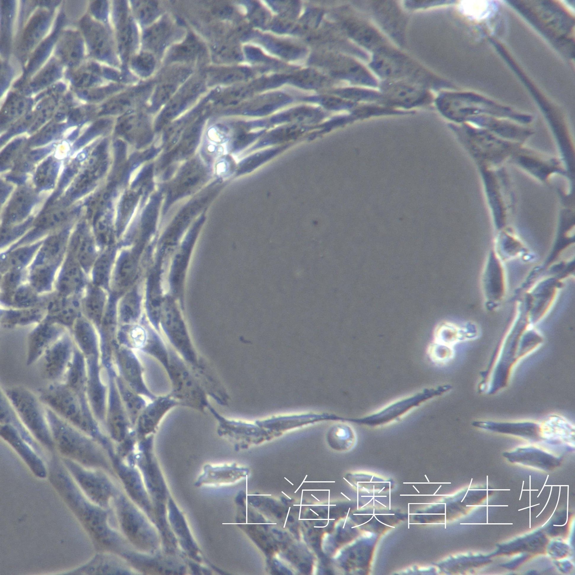 膀胱移行癌细胞UM-UC-3