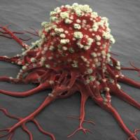 SUIT-2 人胰腺癌细胞