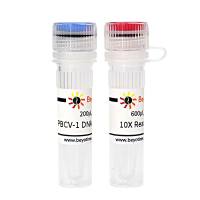 PBCV-1 DNA Ligase