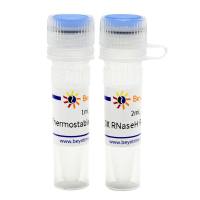 Thermostable RNase H