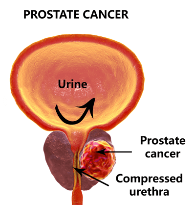 文献速递│动物活体成像系统在前列腺癌治疗研究中的应用