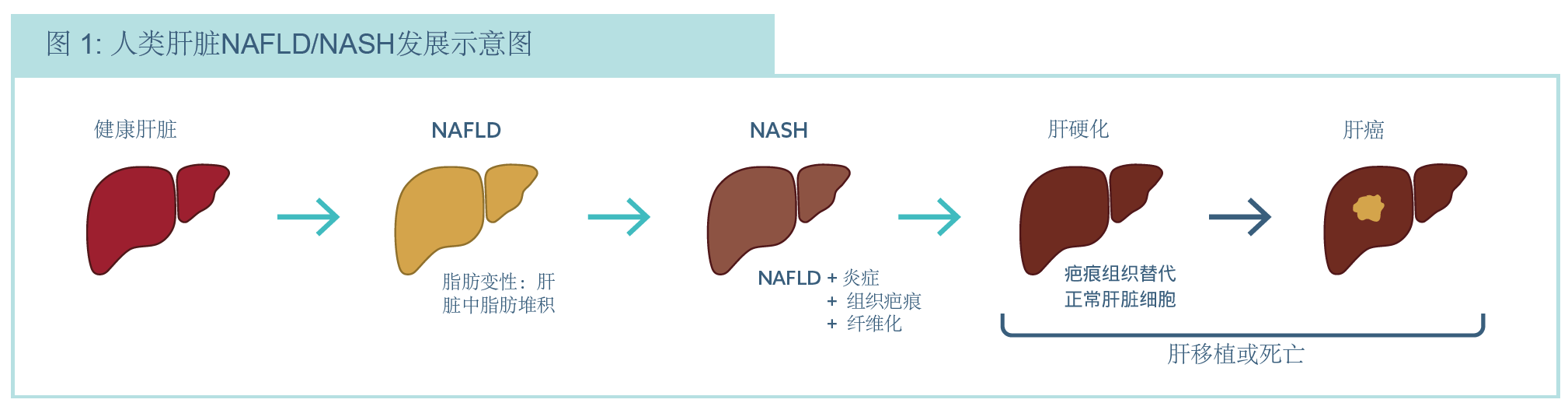 Organ On Chip技术应用|基于人源器官芯片的NASH药物开发
