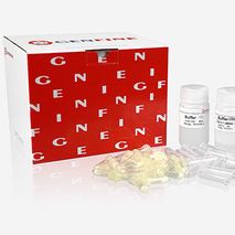 FinePure快速病毒DNA/RNA柱式提取试剂盒（快速版）