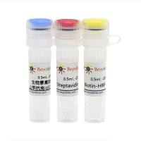 SABC-HRP Kit with Anti-Rabbit IgG (IHC&ICC)