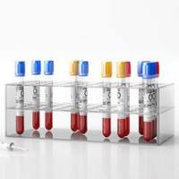 FineOut血液基因组提取试剂盒