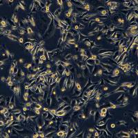 人腺癌细胞 PC-3(Luc2)现货