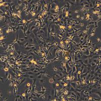 人卵巢癌细胞 SK-OV-3