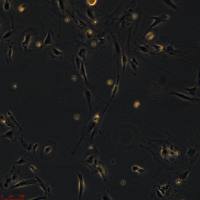 浙江美森-人正常结肠上皮细胞系 CCD 841 CoN