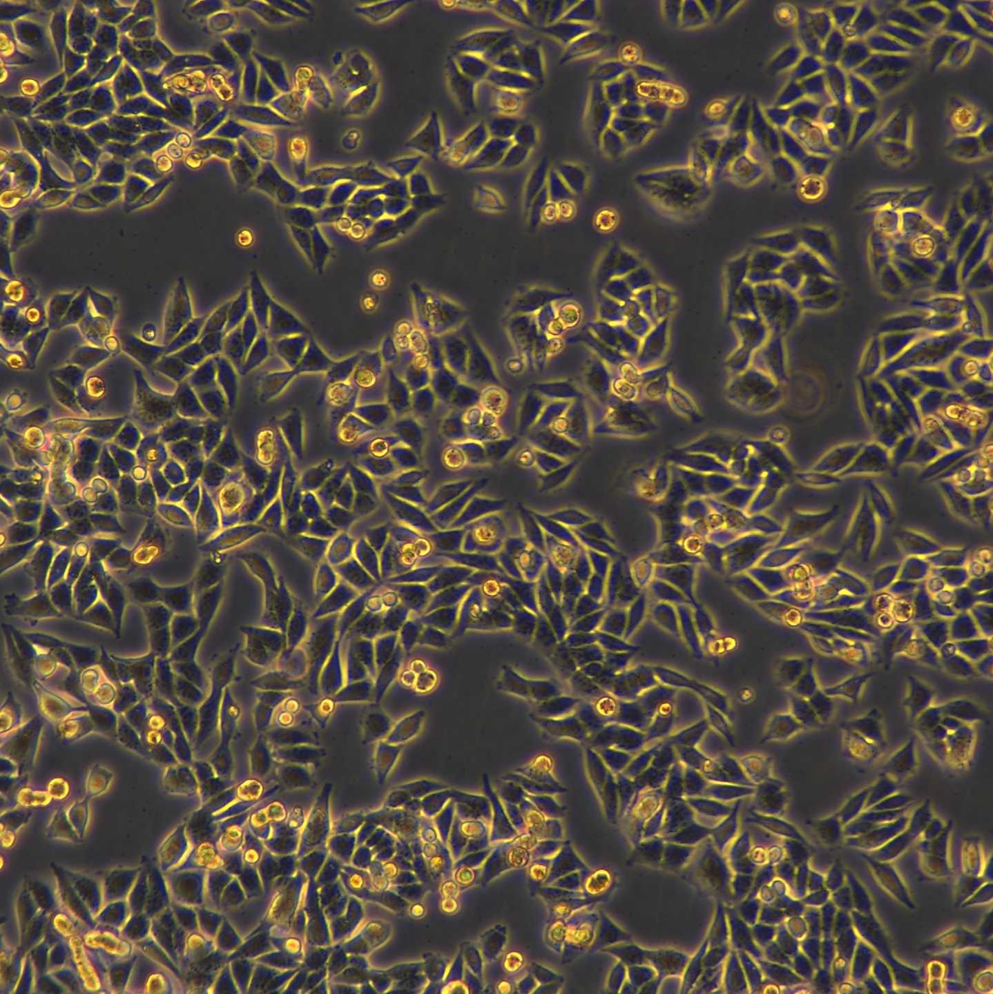 浙江美森-人恶性黑色素瘤细胞 A-375