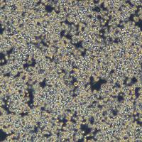 小鼠单核巨噬细胞白血病细胞RAW 264.7