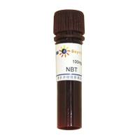 NBT