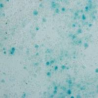 β-半乳糖苷酶染色