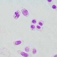 改良本酚品红染色