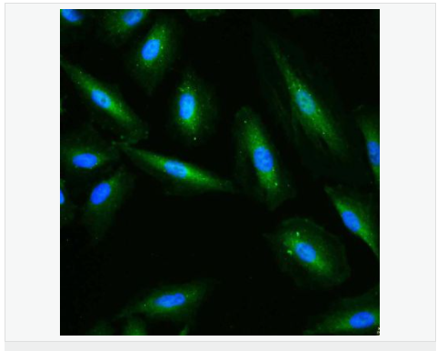 3-磷酸甘油醛脱氢酶（内参）抗体