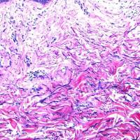 间苯二酚碱性品红染色