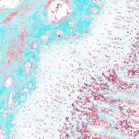 Goldner三色法染色