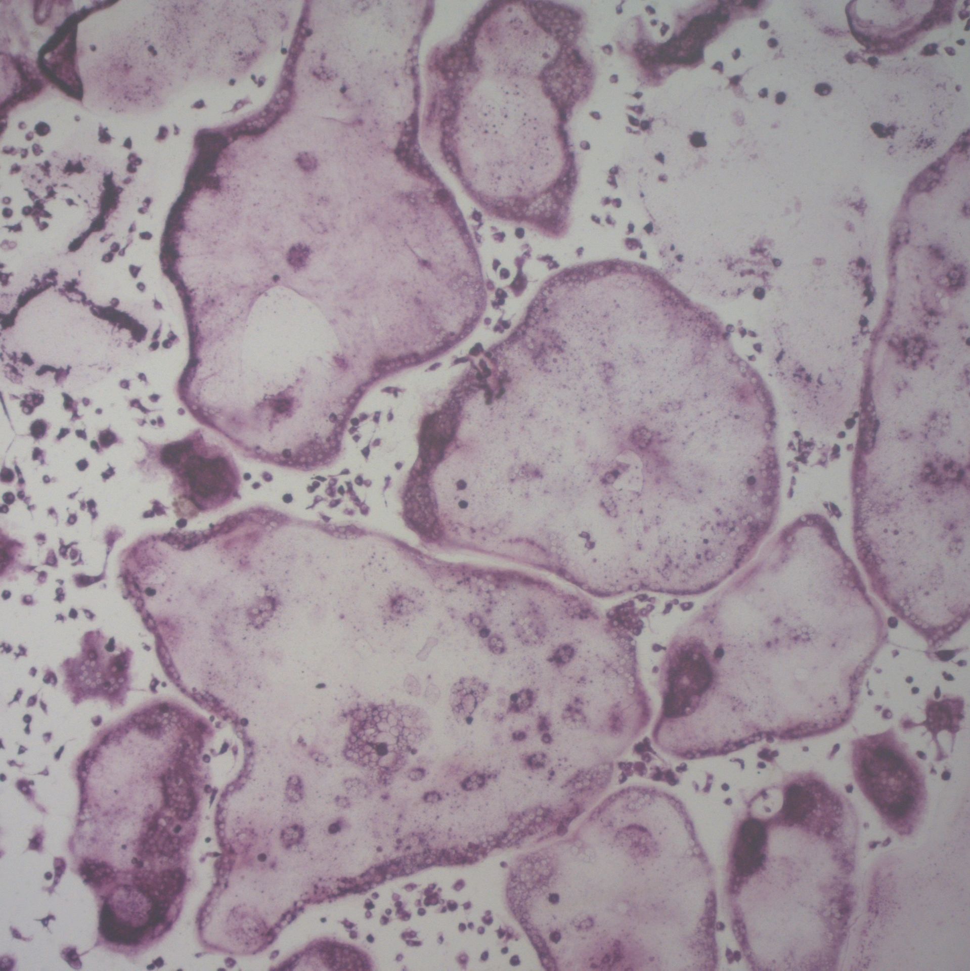 抗酒石酸酸性磷酸酶（Tartrate-Resistant Acid phosphatase, TRAP）染液