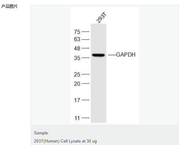 3-磷酸甘油醛脱氢酶（内参）抗体