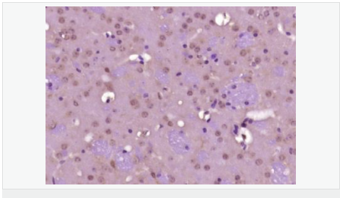 3-磷酸甘油醛脱氢酶（内参）抗体