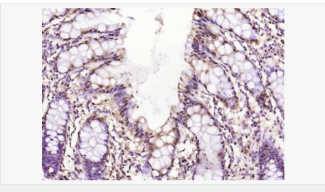 3-磷酸甘油醛脱氢酶（内参）抗体