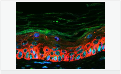 CXC趋化因子16抗体