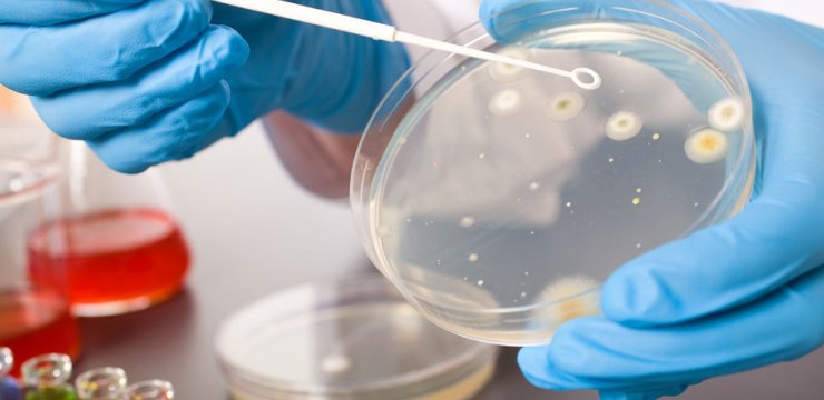 微生物实验这些一定要注意！