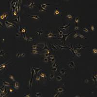 浙江美森-小鼠脑微血管内皮细胞株bend.3