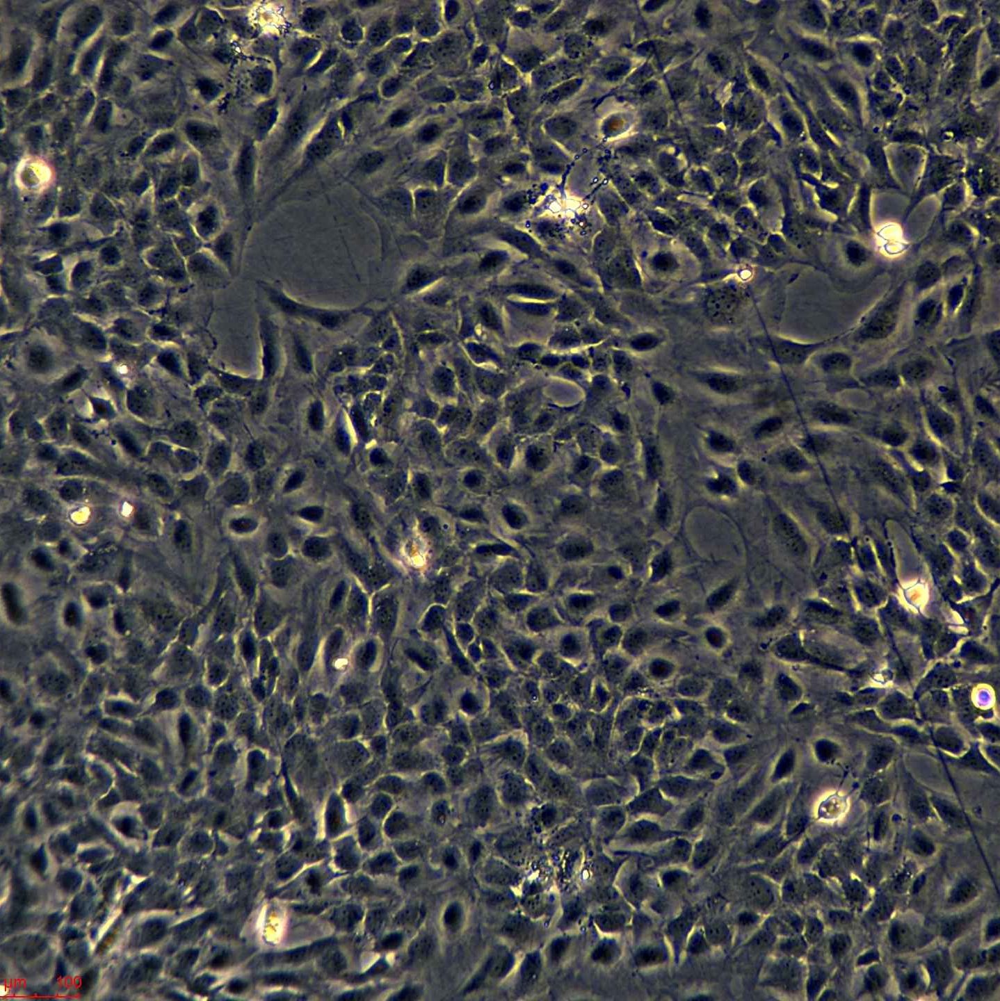 浙江（杭州）美森 人支气管上皮细胞BEAS-2B