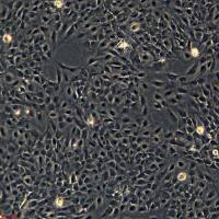 浙江（杭州）美森 人支气管上皮细胞BEAS-2B