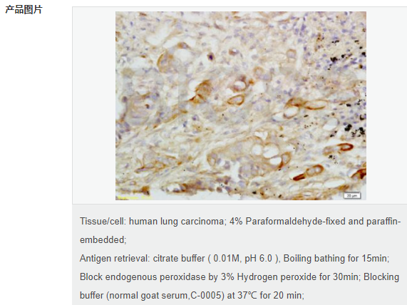 CXC趋化因子16抗体