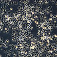 浙江美森-鼻咽癌细胞株 5-8F