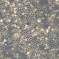 人膀胱癌细胞 5637